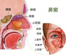 【全國(guó)愛(ài)鼻日】孩子出現(xiàn)這些癥狀，警惕鼻竇炎！ 